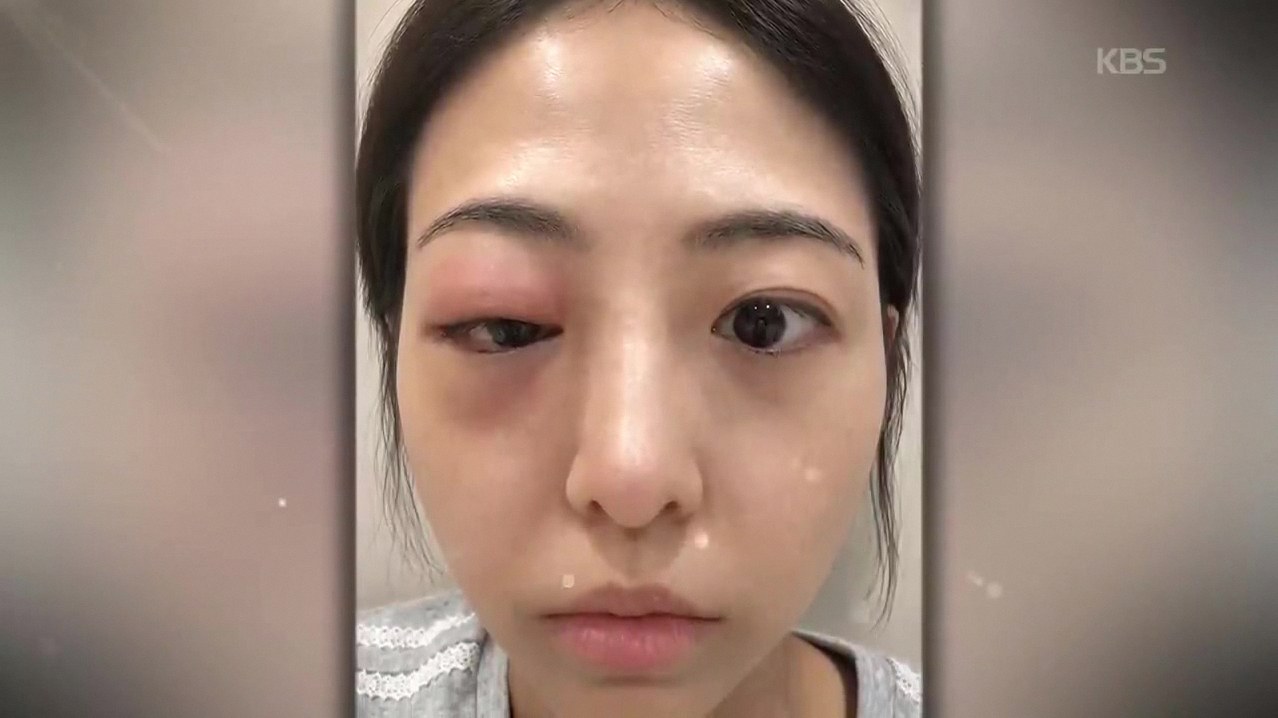 인간극장 오현호 1